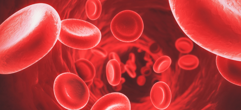 Hyperlipidemia MKexpressnet