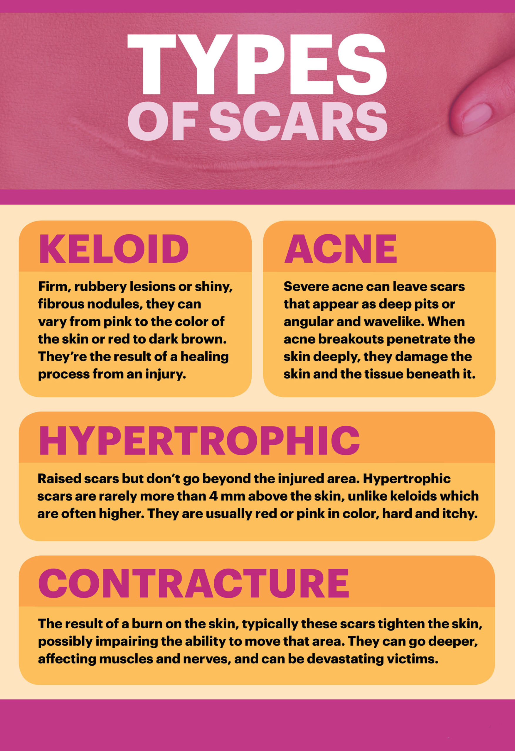 Types of scars Mkexpressnet