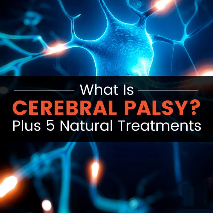 Cerebral Palsy Life Expectancy