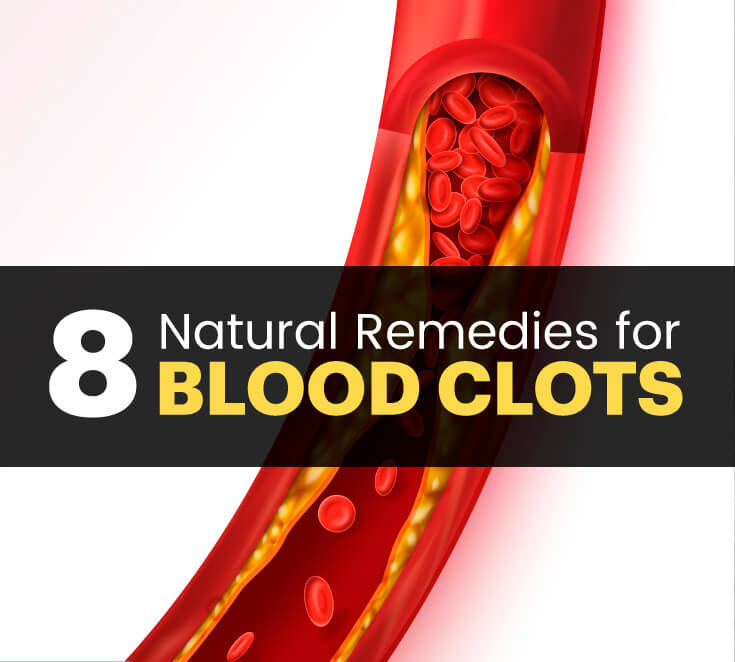 natural remedies for blood clots