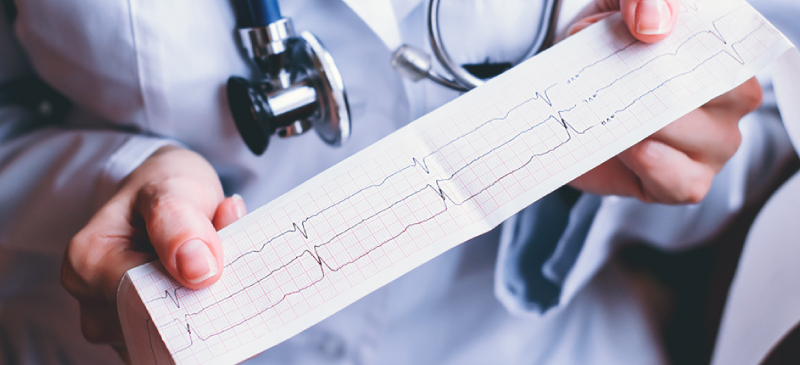 Bradycardia MKexpressnet