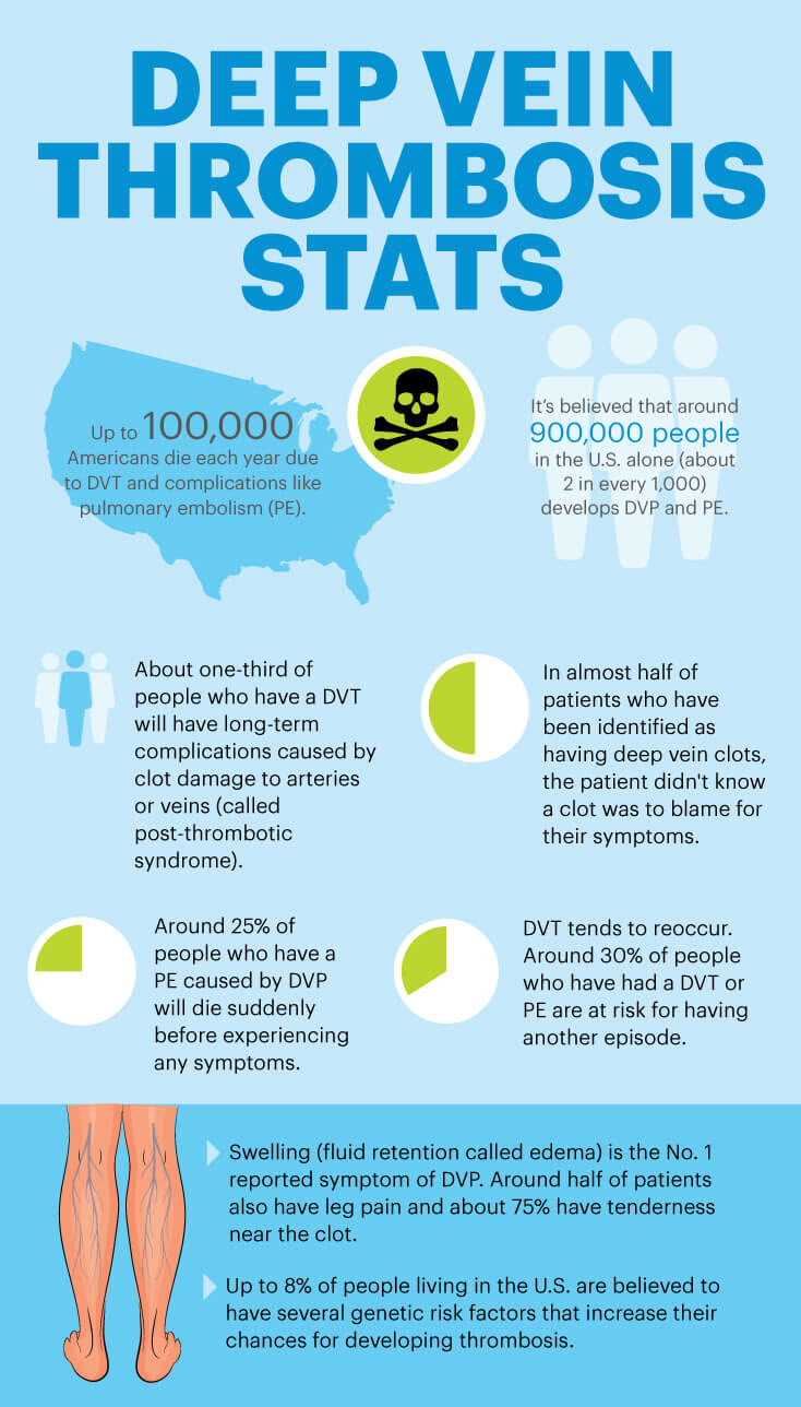 Deep vein thrombosis stats - MKexpress.net
