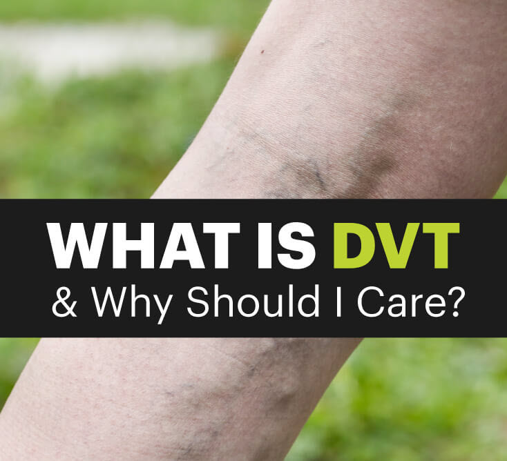 Deep vein thrombosis - MKexpress.net