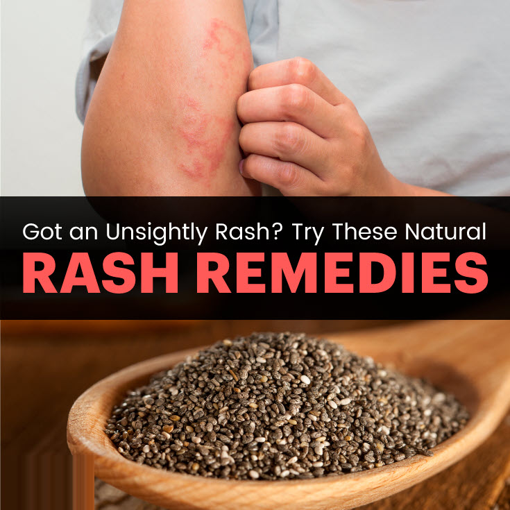 How to Get Rid of a Rash