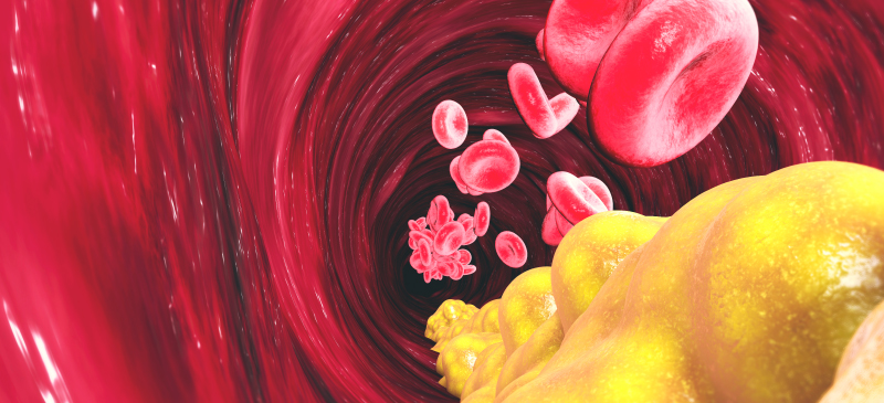 How to lower cholesterol naturally