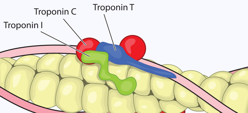 Troponin levels MKexpressnet