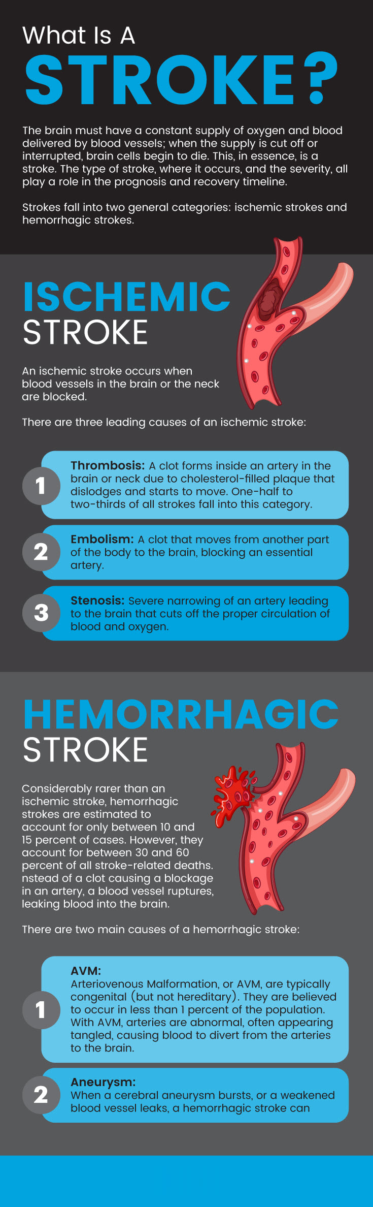 What is a stroke warning signs of a stroke MKexpressnet