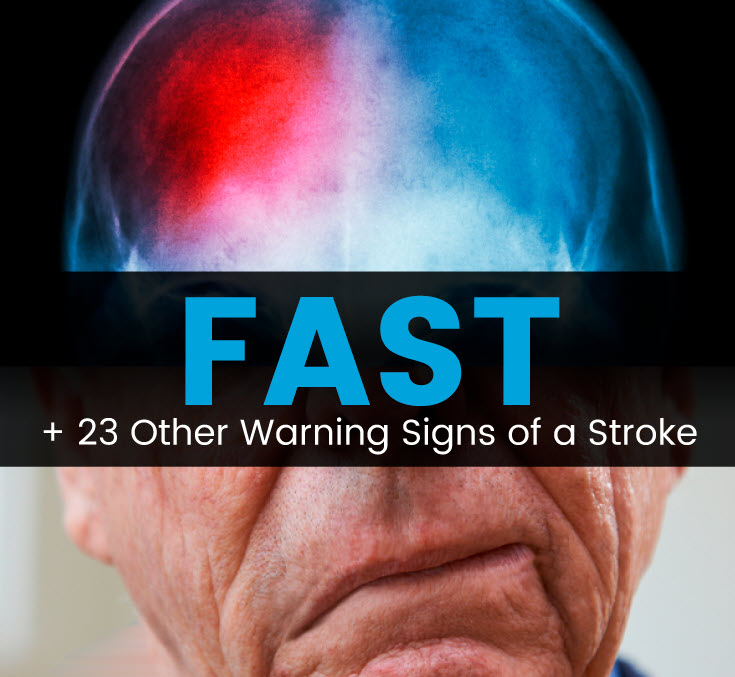 Warning Signs of a Stroke