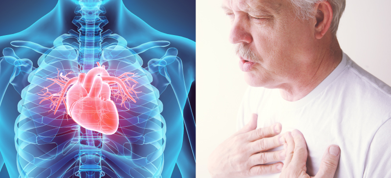 Myocarditis: Causes 45% of Heart Transplants in the U.S. Each Year