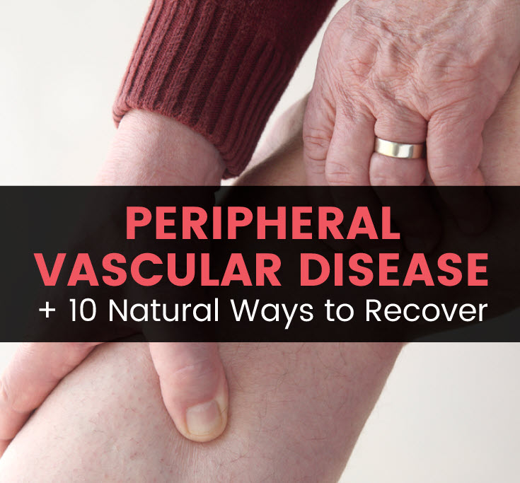 Peripheral vascular disease - MKexpress.net