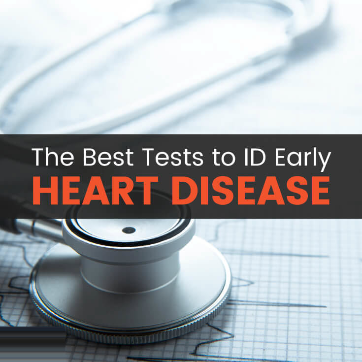 Heart disease tests - MKexpress.net