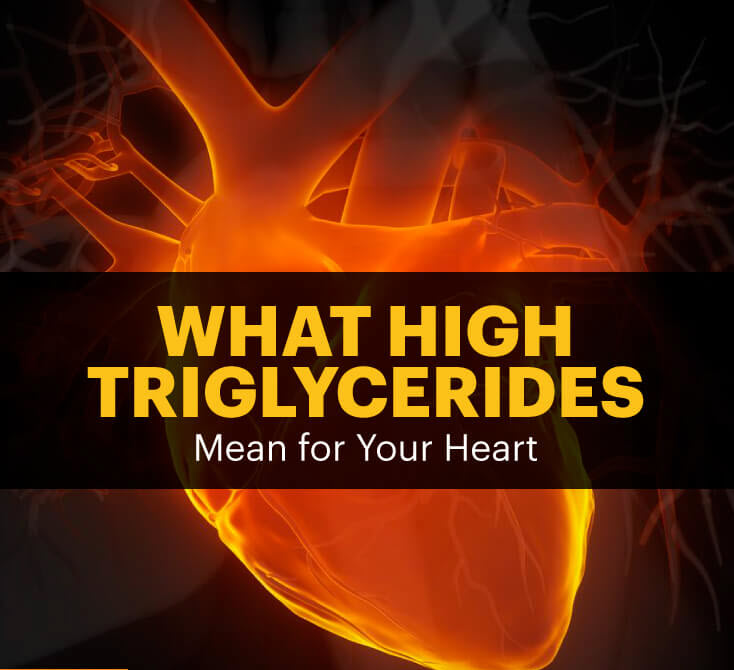 High triglycerides - MKexpress.net