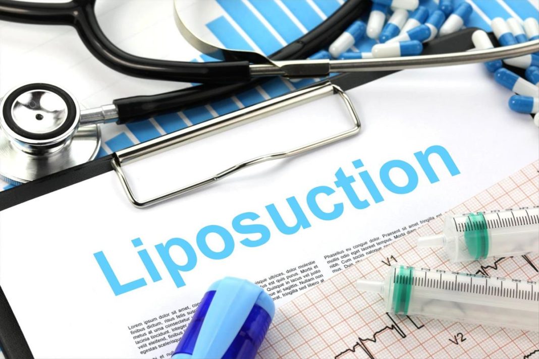 Liposuction Under Local Anesthesia is Safe Procedure? And 6 Liposuction