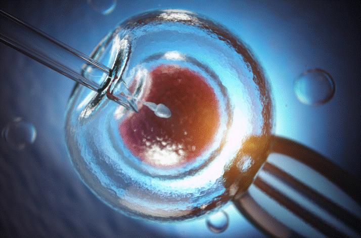 In vitro fertilization
