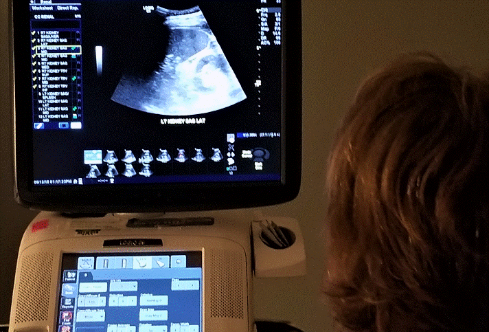 Bladder Ultrasound