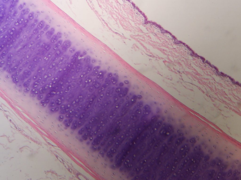perichondrium